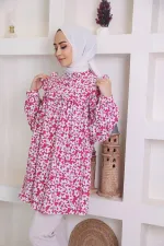 Moda Çizgi Desenli Tunik